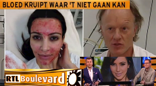 vampire-facial kim-kardashian rtl-boulevard aangezicht - drstevens.nl