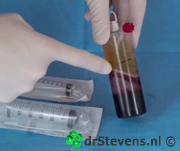 operatietechniek bloedplaatjes plasma groeifactoren cellen bio-chirurgie aangezicht - drstevens.nl