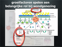 techniek bio-chirurgie groeifactoren wondgenezing - drstevens.nl
