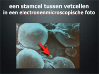 techniek bio-chirurgie stamcel - drstevens.nl